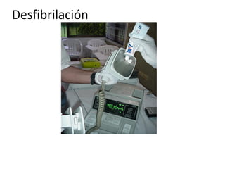 Desfibrilación

Asegúrese de colocar gel en las palas. Este disminuirá la resistencia al
flujo de la corriente y actuará como conductor. No frote una paleta contra
la otra.

 