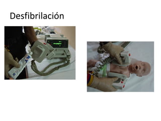 Desfibrilación

No olvide colocar gel en las paletas y ponerlas en posición
adecuada.

 