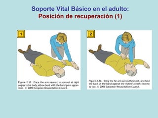 Soporte Vital Básico en el adulto:
Posición de recuperación (1)
1 2
 