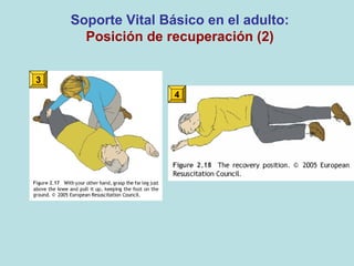 3
Soporte Vital Básico en el adulto:
Posición de recuperación (2)
4
 
