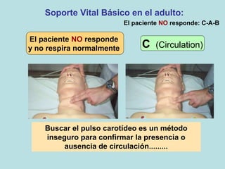 El paciente NO responde
y no respira normalmente
Soporte Vital Básico en el adulto:
C (Circulation)
El paciente NO responde: C-A-B
Buscar el pulso carotídeo es un método
inseguro para confirmar la presencia o
ausencia de circulación.........
 