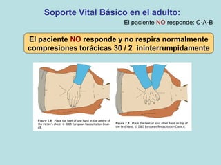 El paciente NO responde y no respira normalmente
compresiones torácicas 30 / 2 ininterrumpidamente
Soporte Vital Básico en el adulto:
El paciente NO responde: C-A-B
 