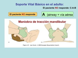 Soporte Vital Básico en el adulto:
Maniobra de tracción mandibular
El paciente NO responde A (airway = vía aérea
El paciente NO responde: C-A-B
 