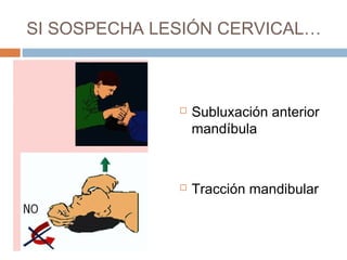 SI SOSPECHA LESIÓN CERVICAL…
 Subluxación anterior
mandíbula
 Tracción mandibular
 