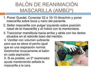 BALÓN DE REANIMACIÓN
MASCARILLA (AMBÚ®
)
1. Poner Guedel. Conectar 02 a 10-15 litros/min y poner
mascarilla sobre boca y nariz del paciente.
2. Sellar mascarilla con pulgar izquierdo sobre posición
nasal de la mascarilla y el índice con la mentoniana.
3. Traccionar mandíbula hacia arriba y atrás con los dedos
situados en el reborde óseo del mentón.
4. Ventilar con volumen suficiente
para que se eleve el pecho igual
que en una respiración normal.
Deshinchar bruscamente el balón
en cada espiración.
5. Si es posible, un 2º reanimador
ayuda manteniendo sellada la
mascarilla a la cara.
 