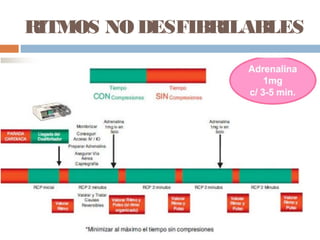 RITMOS NO DESFIBRILABLES
 