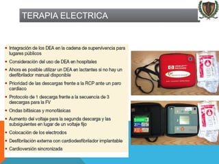 TERAPIA ELECTRICA
 