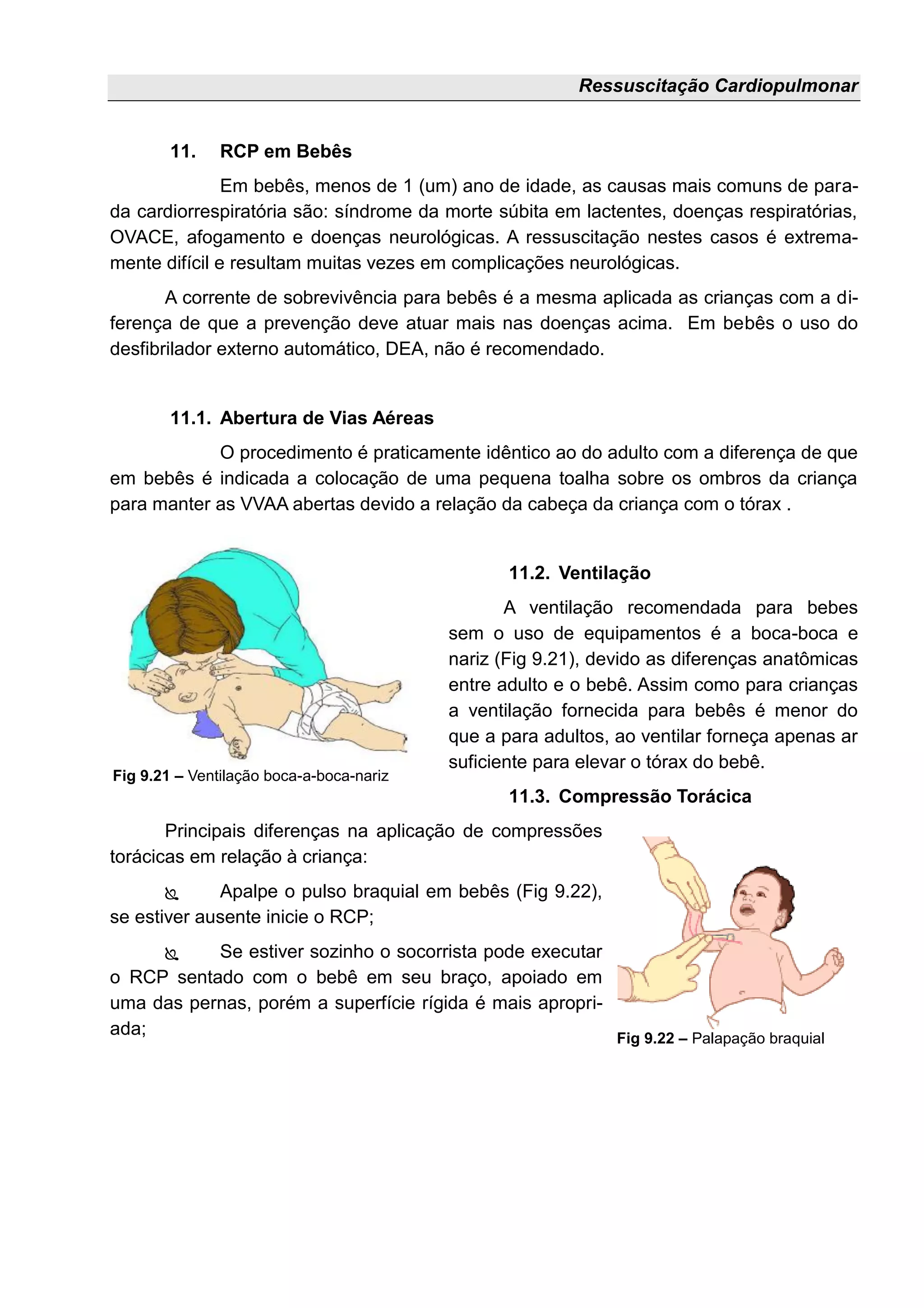 Ressuscitação Cardiopulmonar
11. RCP em Bebês
Em bebês, menos de 1 (um) ano de idade, as causas mais comuns de para-
da cardiorrespiratória são: síndrome da morte súbita em lactentes, doenças respiratórias,
OVACE, afogamento e doenças neurológicas. A ressuscitação nestes casos é extrema-
mente difícil e resultam muitas vezes em complicações neurológicas.
A corrente de sobrevivência para bebês é a mesma aplicada as crianças com a di-
ferença de que a prevenção deve atuar mais nas doenças acima. Em bebês o uso do
desfibrilador externo automático, DEA, não é recomendado.
11.1. Abertura de Vias Aéreas
O procedimento é praticamente idêntico ao do adulto com a diferença de que
em bebês é indicada a colocação de uma pequena toalha sobre os ombros da criança
para manter as VVAA abertas devido a relação da cabeça da criança com o tórax .
11.2. Ventilação
A ventilação recomendada para bebes
sem o uso de equipamentos é a boca-boca e
nariz (Fig 9.21), devido as diferenças anatômicas
entre adulto e o bebê. Assim como para crianças
a ventilação fornecida para bebês é menor do
que a para adultos, ao ventilar forneça apenas ar
suficiente para elevar o tórax do bebê.
11.3. Compressão Torácica
Principais diferenças na aplicação de compressões
torácicas em relação à criança:
 Apalpe o pulso braquial em bebês (Fig 9.22),
se estiver ausente inicie o RCP;
 Se estiver sozinho o socorrista pode executar
o RCP sentado com o bebê em seu braço, apoiado em
uma das pernas, porém a superfície rígida é mais apropri-
ada;
Fig 9.21 – Ventilação boca-a-boca-nariz
Fig 9.22 – Palapação braquial
 