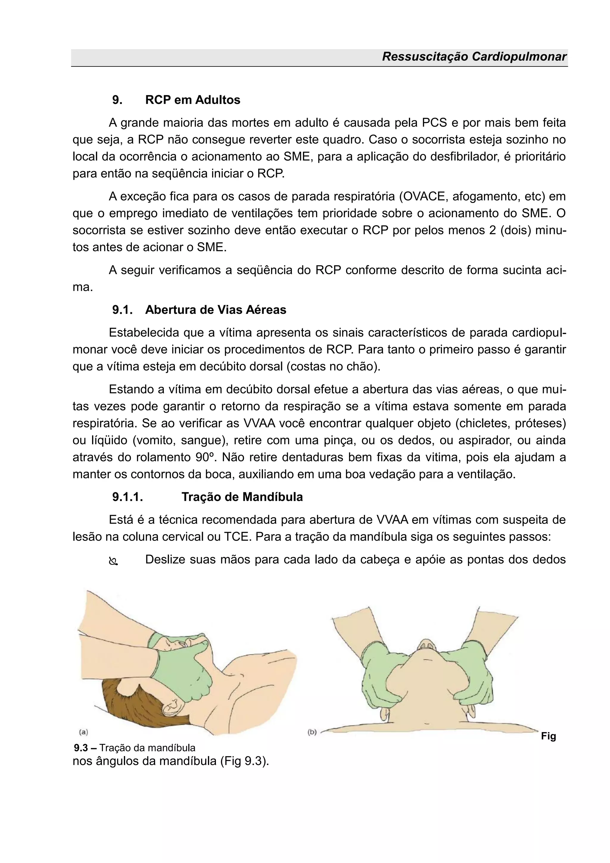 Ressuscitação Cardiopulmonar
9. RCP em Adultos
A grande maioria das mortes em adulto é causada pela PCS e por mais bem feita
que seja, a RCP não consegue reverter este quadro. Caso o socorrista esteja sozinho no
local da ocorrência o acionamento ao SME, para a aplicação do desfibrilador, é prioritário
para então na seqüência iniciar o RCP.
A exceção fica para os casos de parada respiratória (OVACE, afogamento, etc) em
que o emprego imediato de ventilações tem prioridade sobre o acionamento do SME. O
socorrista se estiver sozinho deve então executar o RCP por pelos menos 2 (dois) minu-
tos antes de acionar o SME.
A seguir verificamos a seqüência do RCP conforme descrito de forma sucinta aci-
ma.
9.1. Abertura de Vias Aéreas
Estabelecida que a vítima apresenta os sinais característicos de parada cardiopul-
monar você deve iniciar os procedimentos de RCP. Para tanto o primeiro passo é garantir
que a vítima esteja em decúbito dorsal (costas no chão).
Estando a vítima em decúbito dorsal efetue a abertura das vias aéreas, o que mui-
tas vezes pode garantir o retorno da respiração se a vítima estava somente em parada
respiratória. Se ao verificar as VVAA você encontrar qualquer objeto (chicletes, próteses)
ou líqüido (vomito, sangue), retire com uma pinça, ou os dedos, ou aspirador, ou ainda
através do rolamento 90º. Não retire dentaduras bem fixas da vitima, pois ela ajudam a
manter os contornos da boca, auxiliando em uma boa vedação para a ventilação.
9.1.1. Tração de Mandíbula
Está é a técnica recomendada para abertura de VVAA em vítimas com suspeita de
lesão na coluna cervical ou TCE. Para a tração da mandíbula siga os seguintes passos:
 Deslize suas mãos para cada lado da cabeça e apóie as pontas dos dedos
nos ângulos da mandíbula (Fig 9.3).
Fig
9.3 – Tração da mandíbula
 