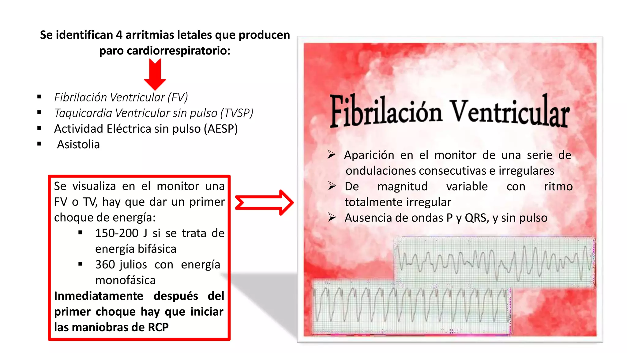 Se identifican 4 arritmias letales que producen
paro cardiorrespiratorio:
 Fibrilación Ventricular (FV)
 Taquicardia Ventricular sin pulso (TVSP)
 Actividad Eléctrica sin pulso (AESP)
 Asistolia
 Aparición en el monitor de una serie de
ondulaciones consecutivas e irregulares
 De magnitud variable con ritmo
totalmente irregular
 Ausencia de ondas P y QRS, y sin pulso
Se visualiza en el monitor una
FV o TV, hay que dar un primer
choque de energía:
 150-200 J si se trata de
energía bifásica
 360 julios con energía
monofásica
Inmediatamente después del
primer choque hay que iniciar
las maniobras de RCP
 