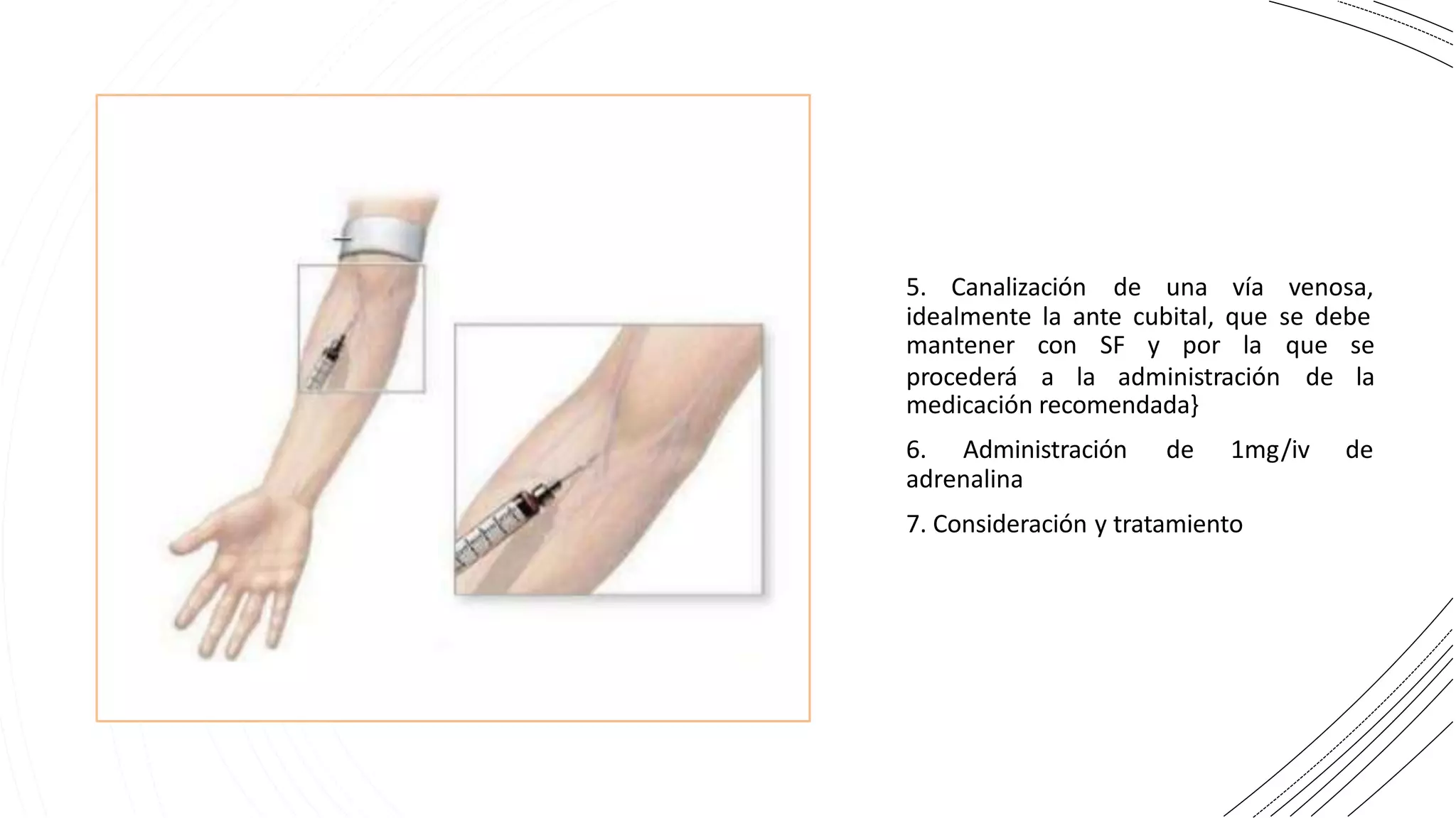 5. Canalización de una vía venosa,
idealmente la ante cubital, que se debe
mantener con SF y por la
procederá a la administración
que se
de la
medicación recomendada}
6. Administración de 1mg/iv de
adrenalina
7. Consideración y tratamiento
 