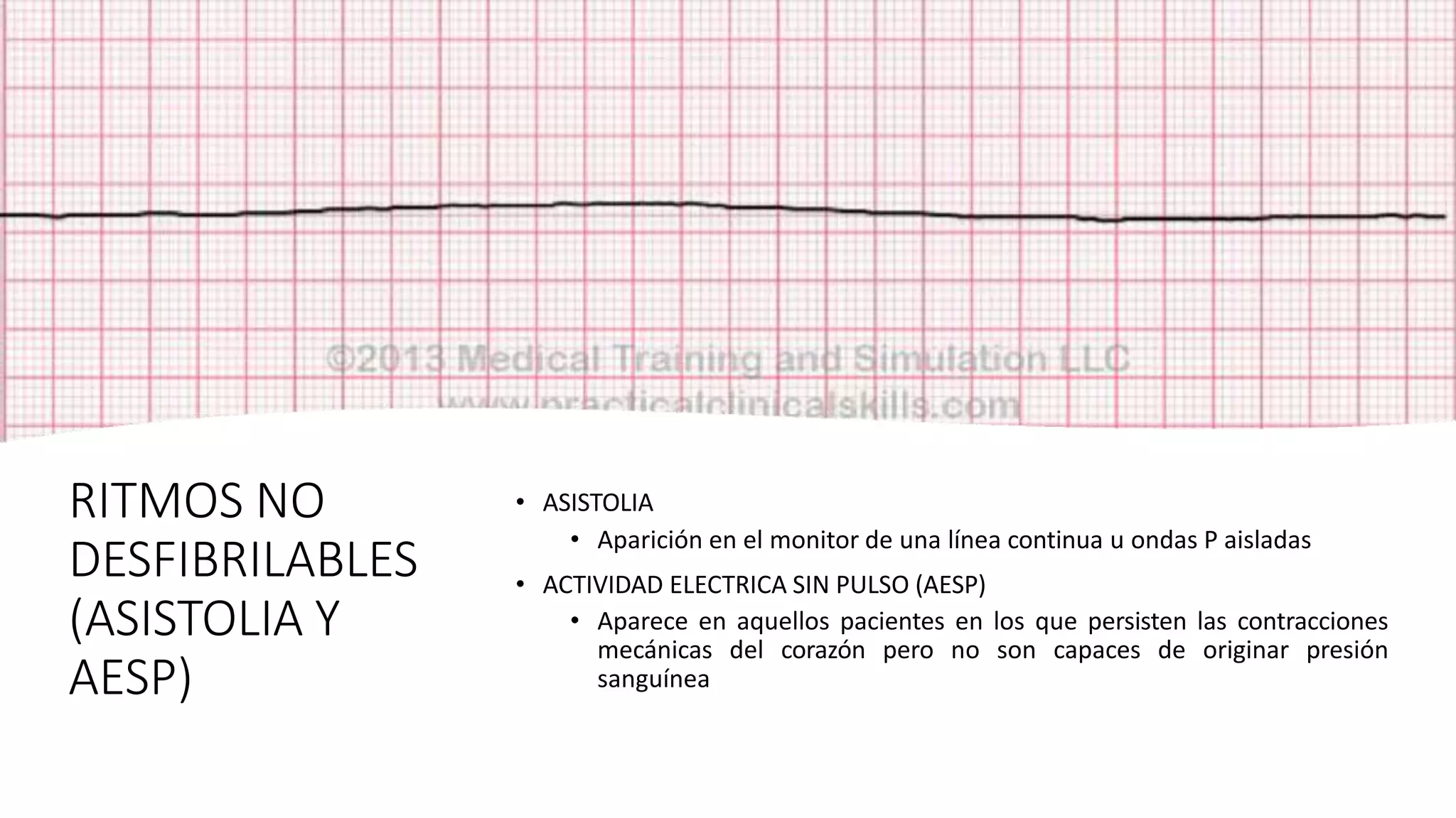 RITMOS NO
DESFIBRILABLES
(ASISTOLIA Y
AESP)
• ASISTOLIA
• Aparición en el monitor de una línea continua u ondas P aisladas
• ACTIVIDAD ELECTRICA SIN PULSO (AESP)
• Aparece en aquellos pacientes en los que persisten las contracciones
mecánicas del corazón pero no son capaces de originar presión
sanguínea
 