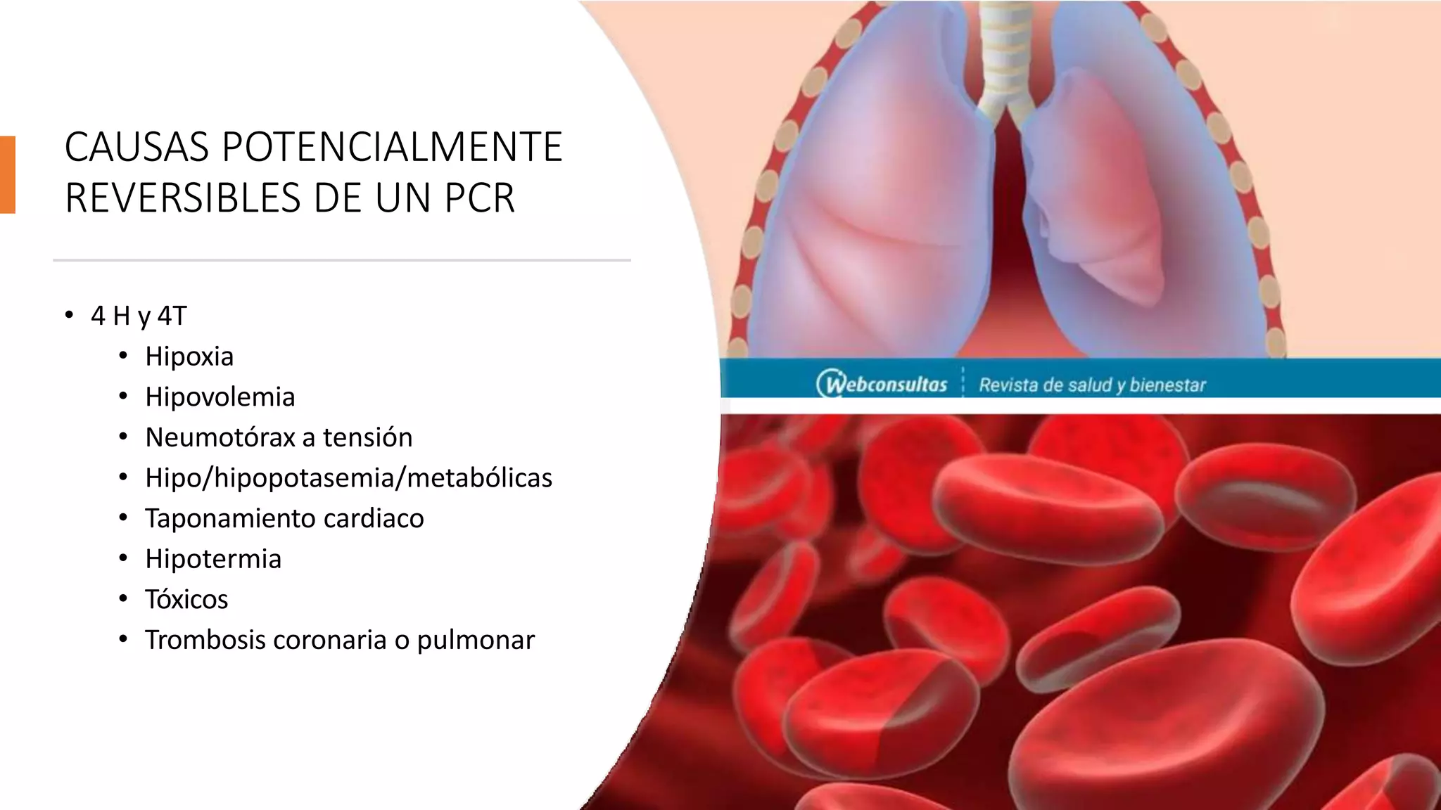 CAUSAS POTENCIALMENTE
REVERSIBLES DE UN PCR
• 4 H y 4T
• Hipoxia
• Hipovolemia
• Neumotórax a tensión
• Hipo/hipopotasemia/metabólicas
• Taponamiento cardiaco
• Hipotermia
• Tóxicos
• Trombosis coronaria o pulmonar
 