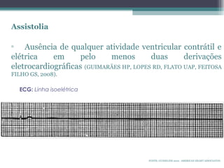 Assistolia
▫ Ausência de qualquer atividade ventricular contrátil e
elétrica em pelo menos duas derivações
eletrocardiográficas (GUIMARÃES HP, LOPES RD, FLATO UAP, FEITOSA
FILHO GS, 2008).
ECG: Linha isoelétrica
FONTE: GUIDELINE 2010. AMERICAN HEART ASSOCIATON.
 