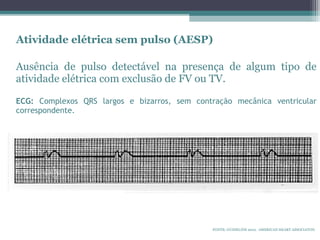Atividade elétrica sem pulso (AESP)
Ausência de pulso detectável na presença de algum tipo de
atividade elétrica com exclusão de FV ou TV.
ECG: Complexos QRS largos e bizarros, sem contração mecânica ventricular
correspondente.
FONTE: GUIDELINE 2010. AMERICAN HEART ASSOCIATON.
 