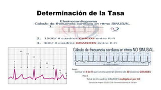 Determinación de la Tasa
 