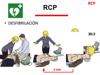 • DESFIBRILACIÓN
RCP
RCP
2 min
30:2
 