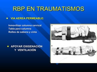 RBP EN TRAUMATISMOS VIA AEREA PERMEABLE: Inmovilizar columna cervical Tabla para columna Rollos de sabana y cinta APOYAR OXIGENACIÓN  Y  VENTILACIÓN 