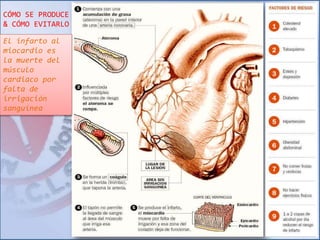 CÓMO SE PRODUCE 
& CÓMO EVITARLO 
El infarto al 
miocardio es 
la muerte del 
músculo 
cardiaco por 
falta de 
irrigación 
sanguínea 
 