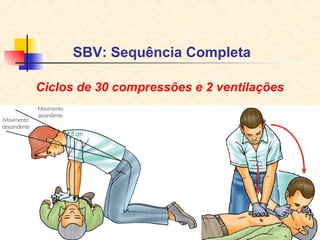 SBV: Sequência Completa
Ciclos de 30 compressões e 2 ventilações

 