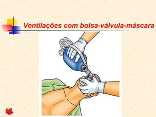 Ventilações com bolsa-válvula-máscara

 