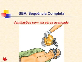 SBV: Sequência Completa
Ventilações com via aérea avançada

 