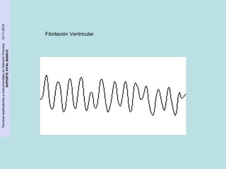 Técnicas exploratorias e instrumentales en Atención Primaria. 15-11-2010 
SOPORTE VITAL BASICO 
Fibrilación Ventricular 
 