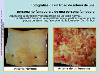 Técnicas exploratorias e instrumentales en Atención Primaria. 15-11-2010 
SOPORTE VITAL BASICO 
Fotografías de un trozo de arteria de una 
persona no fumadora y de una persona fumadora. 
Obsérvese la pared lisa y pálida propia de un tejido normal. 
En la arteria del fumador la pared tiene una superficie rugosa por las 
placas de ateromas, favoreciendo la formación de trombos. 
 