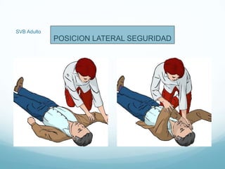 SVB Adulto
POSICION LATERAL SEGURIDAD
 