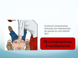 Continuar compresiones
torácicas con respiraciones
de rescate en una relación
30:2
30 compresiones
2 ventilaciones
 