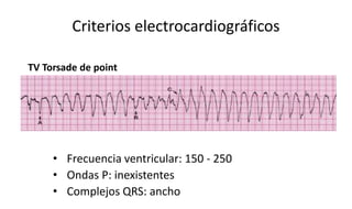 Criterios electrocardiográficos
• Frecuencia ventricular: 150 - 250
• Ondas P: inexistentes
• Complejos QRS: ancho
TV Tors...