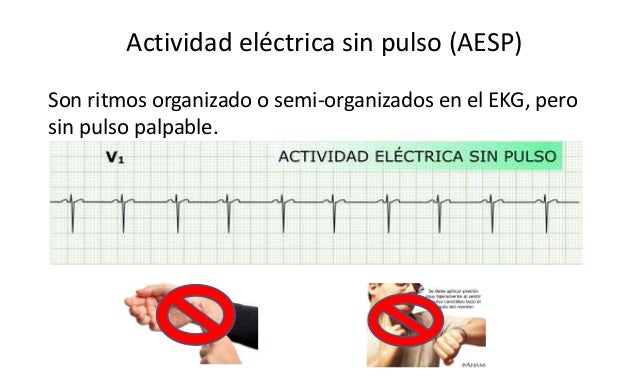 Rcp avanzado