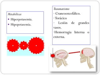 Metabólicas
 Hiperpotasemia.
 Hipopotasemia.
Traumatismo
· Craneoencefálico.
·Torácico
· Lesión de grandes
vasos.
·Hemorragia Interna o
externa.
 