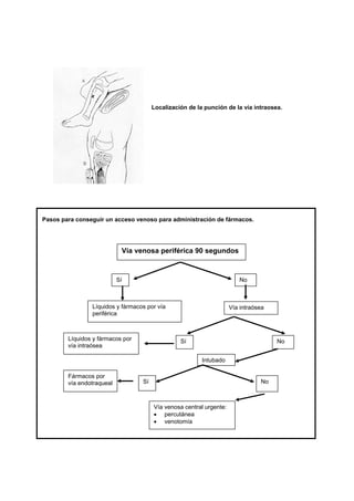 Localización de la punción de la vía intraosea.




Pasos para conseguir un acceso venoso para administración de fármacos.




                            Vía venosa periférica 90 segundos



                           Sí                                           No



                Líquidos y fármacos por vía                          Vía intraósea
                periférica



        Líquidos y fármacos por                  Sí                                  No
        vía intraósea

                                                         Intubado

        Fármacos por
        vía endotraqueal          Sí                                            No



                                       Vía venosa central urgente:
                                       • percutánea
                                       • venotomía
 