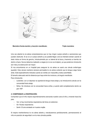 Maniobra frente-mentón y tracción mandibular.                            Triple maniobra




Una vez abierta la vía aérea comprobaremos que no hay ningún cuerpo extraño o secreciones que
puedan obstruirla. Si se ve un cuerpo extraño (y es posible llegar a el) se intentará extraer usando el
dedo índice en forma de gancho, introduciéndolo por un lateral de la boca y haciendo un barrido de
dentro a fuera. Nunca debemos realizarlo a ciegas (si no se ve el objeto), ya que podemos introducirlo
aún más y la obstrucción ser mayor.
Si nos encontramos en un hospital para asegurar la vía aérea se usará una cánula orofaríngea
(guedel). Esta cánula mantiene siempre permeable la vía aérea evitando que la lengua caiga hacia
atrás. Está especialmente indicada cuando se ventila con mascarilla y bolsa autoinflable.
El tamaño adecuado será la distancia que haya entre los incisivos y el ángulo mandibular.
Para introducirla:
    -   Lactantes: con un depresor se apartará la lengua hacia abajo y se introducirá la cánula con la
        concavidad hacia abajo.
    -   Niños: Se introduce con la concavidad hacia arriba y cuando esté completamente dentro se
        gira 180º.


4- COMPROBAR LA RESPIRACIÓN:
Comprobar que el niño respira espontáneamente acercando nuestra cara al niño y mirando hacia los
pies.
    -   Ver: si hay movimientos respiratorios del tórax y/o abdomen.
    -   Oir: Ruidos respiratorios.
    -   Sentir: El aire exhalado en nuestra mejilla.


Si respira mantendremos la vía aérea abierta y reevaluaremos periódicamente, permaneciendo el
niño en posición de seguridad o en la más cómoda posible.
 