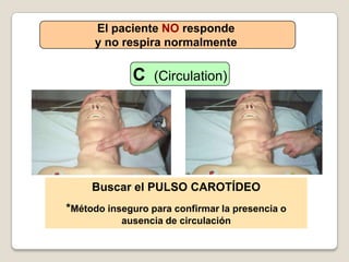 El paciente NO responde
y no respira normalmente
C (Circulation)
Buscar el PULSO CAROTÍDEO
*Método inseguro para confirmar la presencia o
ausencia de circulación
 