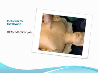 VALORACION RESPIRACIONVER OIRSENTIRNO USAR MAS DE 10 SEGUNDOS PARA VALORAR RESPIRACION.