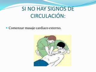 COMPROBAR SIGNOS DE CIRCULACIÓNObservar si la victima realiza algún movimientoBuscar pulso carotideoNO TARDAR MAS DE DIEZ SEGUNDOS