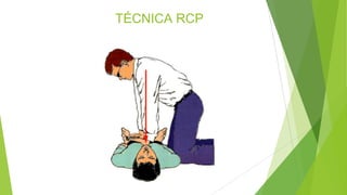 TÉCNICA RCP
 