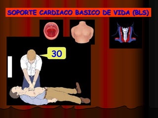 RCP BASICALINEA INTERMAMILAR  LINEAMEDIAESTERNAL