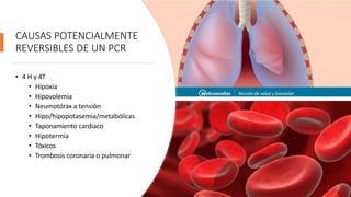 CAUSAS POTENCIALMENTE
REVERSIBLES DE UN PCR
• 4 H y 4T
• Hipoxia
• Hipovolemia
• Neumotórax a tensión
• Hipo/hipopotasemia/metabólicas
• Taponamiento cardiaco
• Hipotermia
• Tóxicos
• Trombosis coronaria o pulmonar
 