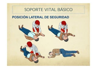 SOPORTE VITAL BÁSICO
POSICIÓN LATERAL DE SEGURIDAD
 
