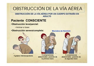 •Obstrucción leve/parcial:
• Animar a toser.
•Obstrucción severa/completa:
Paciente CONSCIENTE
OBSTRUCCIÓN DE LA VÍA AÉREA POR UN CUERPO EXTRAÑO EN
ADULTO
OBSTRUCCIÓN DE LA VÍA AÉREA
5 golpes interescapulares
5 compresiones
abdominales: posición de
la primera mano
5 compresiones
abdominales: posición de
la segunda mano
Maniobra de Heimlich
 
