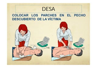 DESA
COLOCAR LOS PARCHES EN EL PECHO
DESCUBIERTO DE LA VÍCTIMA
 