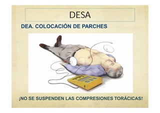 DESA
DEA. COLOCACIÓN DE PARCHES
¡NO SE SUSPENDEN LAS COMPRESIONES TORÁCICAS!
 