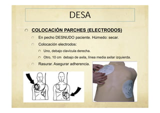 COLOCACIÓN PARCHES (ELECTRODOS)
En pecho DESNUDO paciente. Húmedo: secar.
Colocación electrodos:
Uno, debajo clavícula derecha.
Otro, 10 cm debajo de axila, línea media axilar izquierda.
Rasurar. Asegurar adherencia.
DESA
 