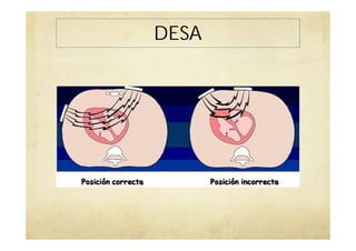 DESA
 