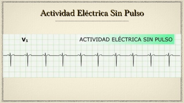 ACLS de AHA versión 2010