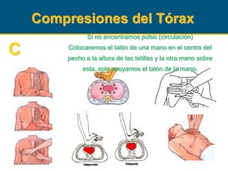Si no encontramos pulso (circulación)
Colocaremos el talón de una mano en el centro del
pecho a la altura de las tetillas y la otra mano sobre
esta, solo apoyamos el talón de la mano.
Compresiones del Tórax
C
 