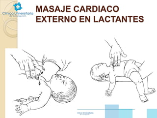 MASAJE CARDIACO
EXTERNO EN LACTANTES

 